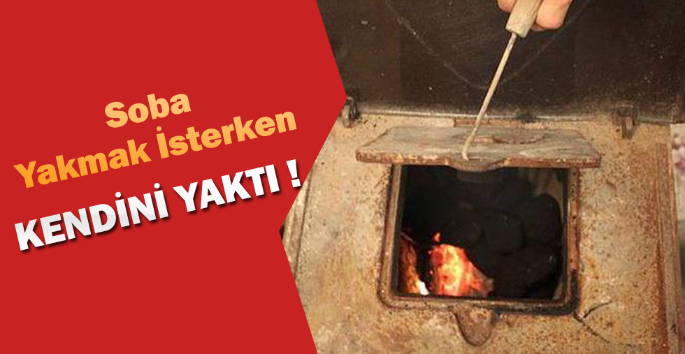 Soba Yakmak İsterken Kendini Yaktı