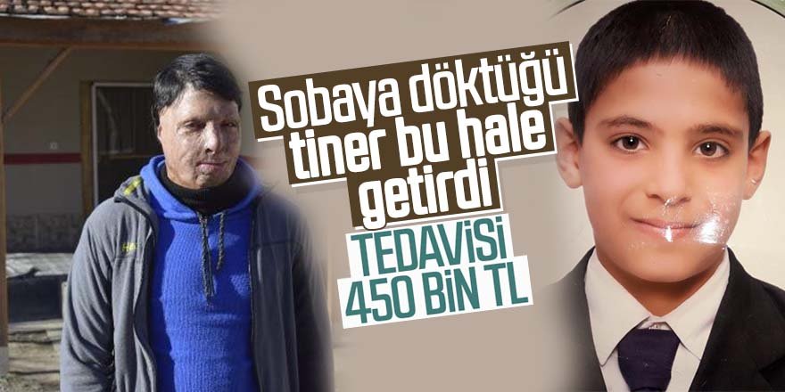 Genç Miraç'ın tedavisi için 450 bin lira gerekiyor