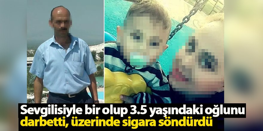 Sevgilisiyle bir olup 3.5 yaşındaki oğlunu darbetti, üzerinde sigara söndürdü