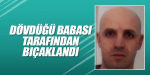 Dövdüğü Babası Tarafından Bıçaklandı