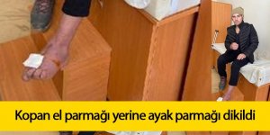 Kopan el parmağı yerine ayak parmağı dikildi