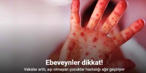 Kızamık vakaları arttı