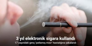 Sigara kullanan genç, "patlamış mısır" hastalığına yakalandı
